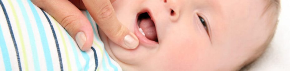 how to treat a childs tongue tie