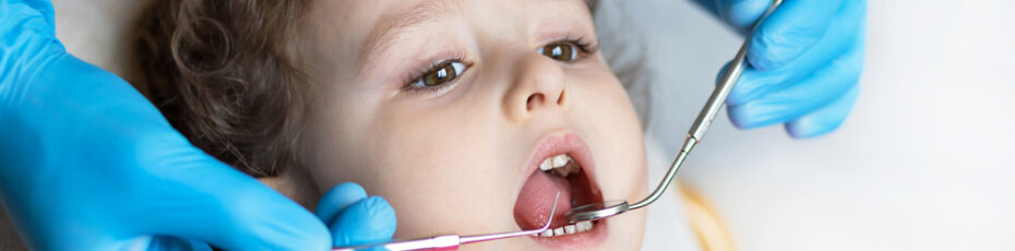 lip tie in children causes symptoms and treatment