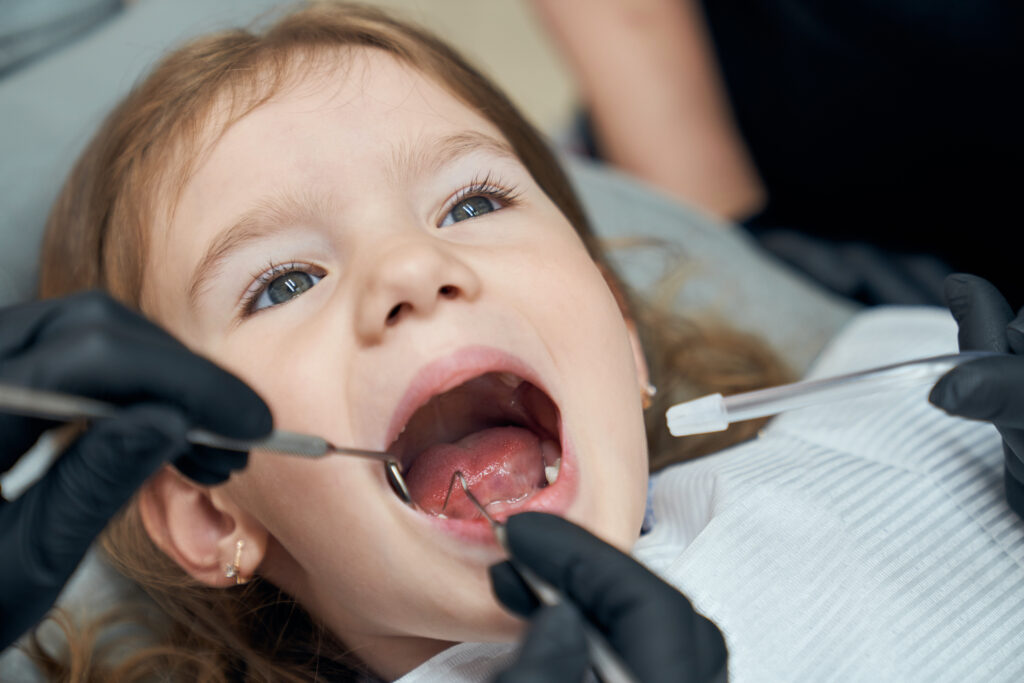 does a tongue-tie affect bottle feeding